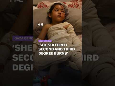 ‘Her mother was killed and she was severely burnt’ says little girl’s grandfather