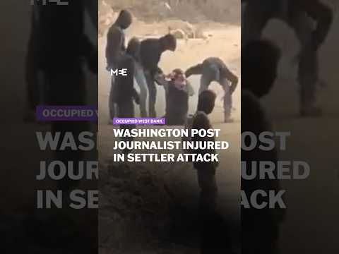 Washington post journalist injured in Settler attack in the occupied West Bank